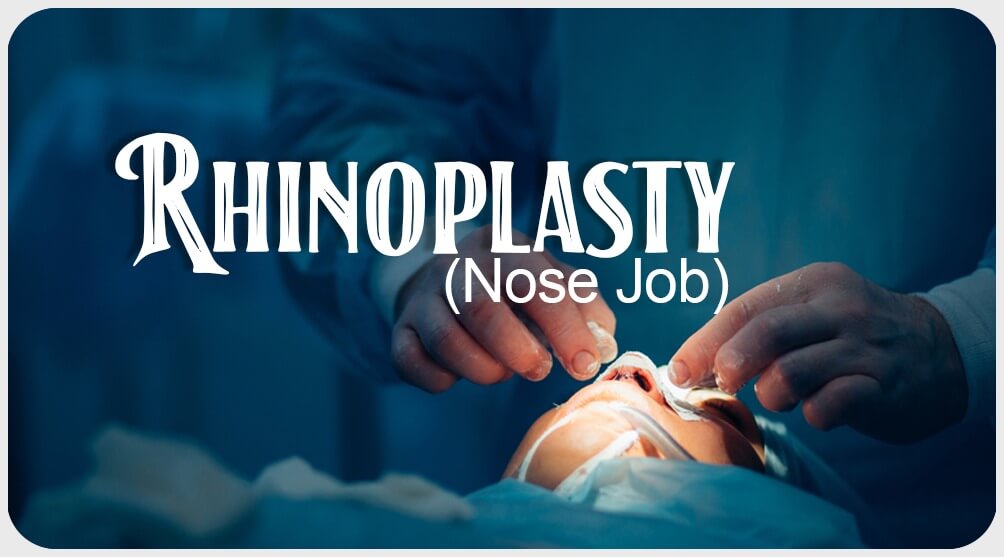 Rhinoplasty nose job