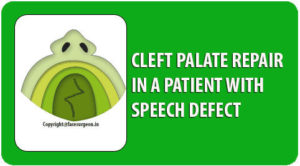 Cleft palate repair Surgery in Tamil Nadu