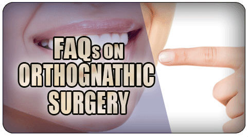 Orthognathic surgery faq