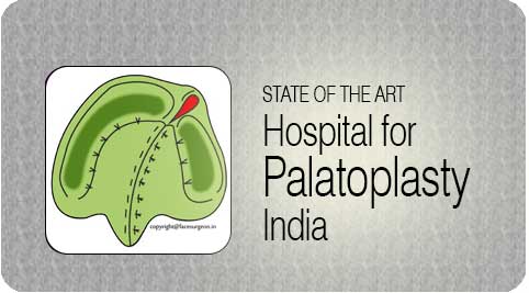 Palatoplasty India