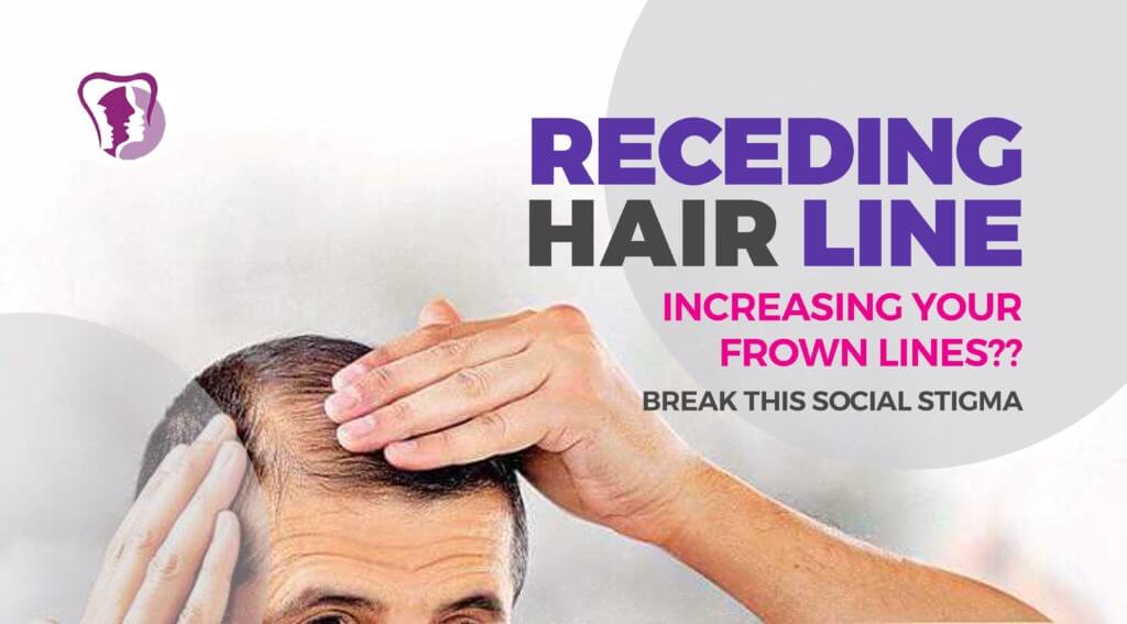 Receding hairline treatment in India