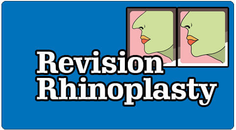 Redo Rhinoplasty Treatment in India