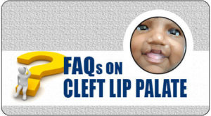 cleft lip and palate Treatment in India