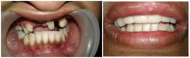 dental treatment in nagercoil