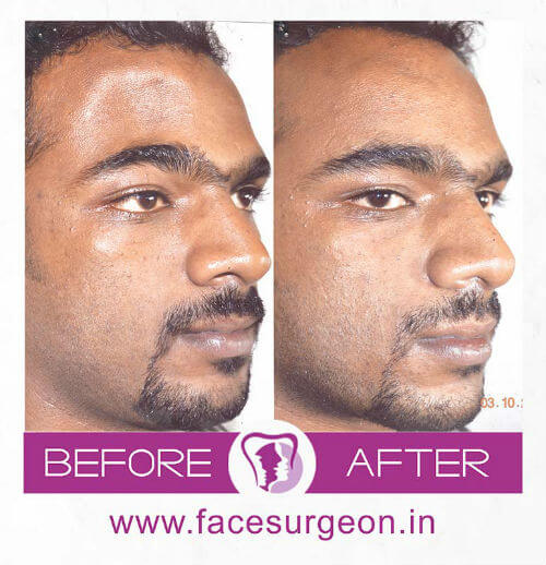 http://Facemakeover%20at%20Richardsons%20Hospital%20India