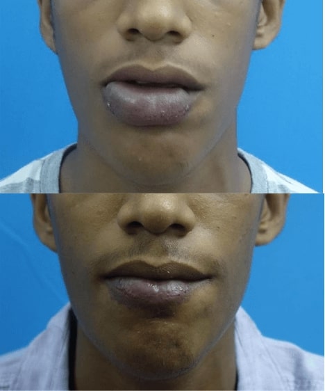 before after pathology surgery in india