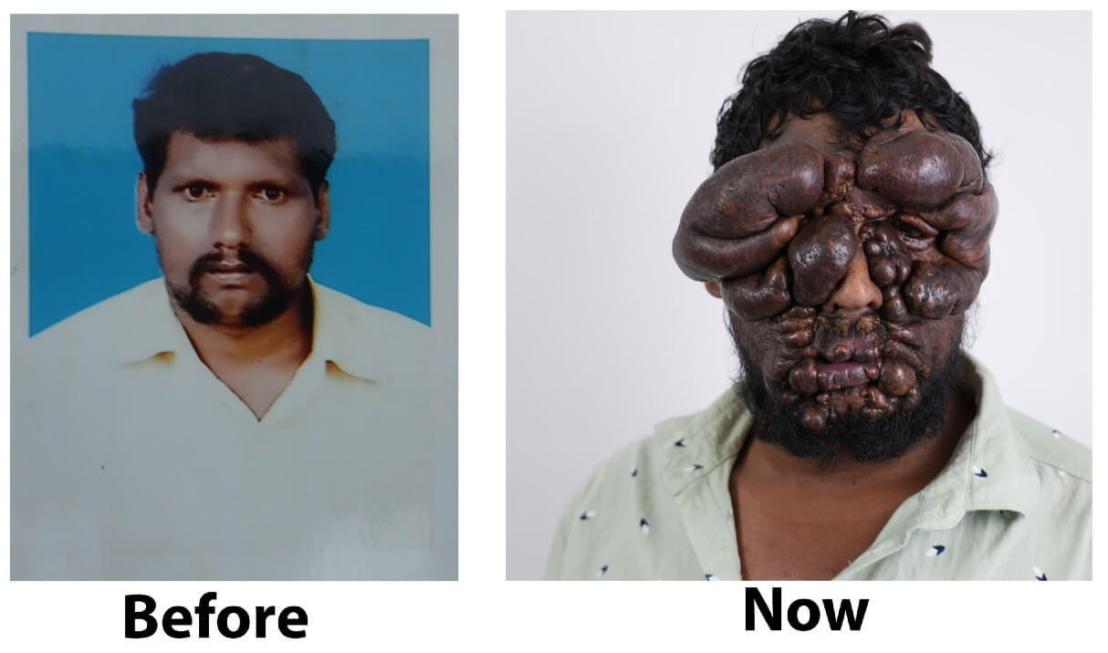 ravikumar before and after