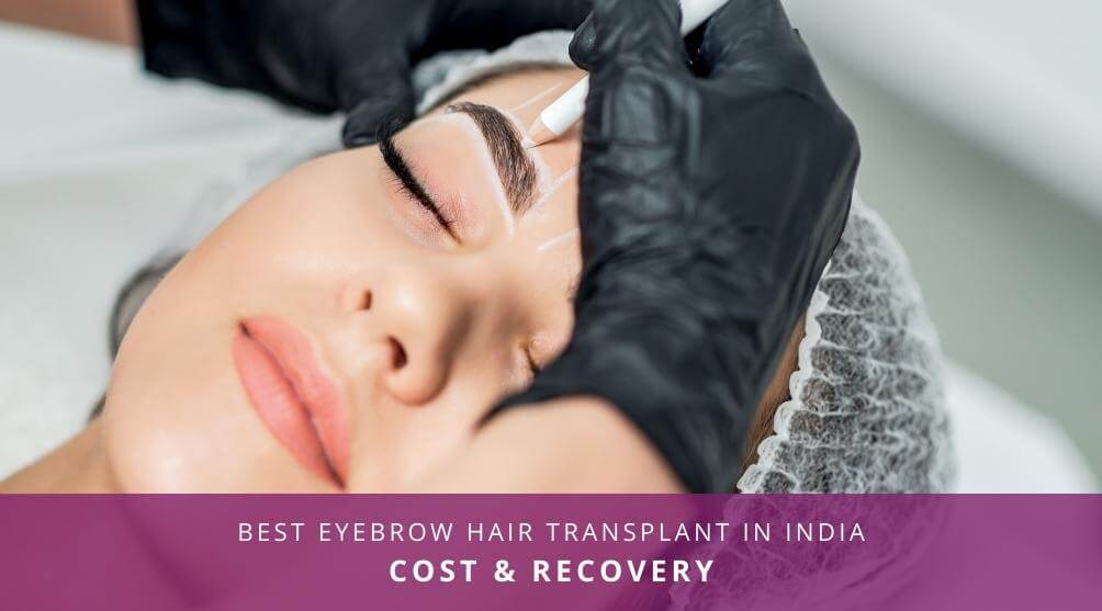 Best Eyebrow Hair Transplant in India | Cost & Recovery