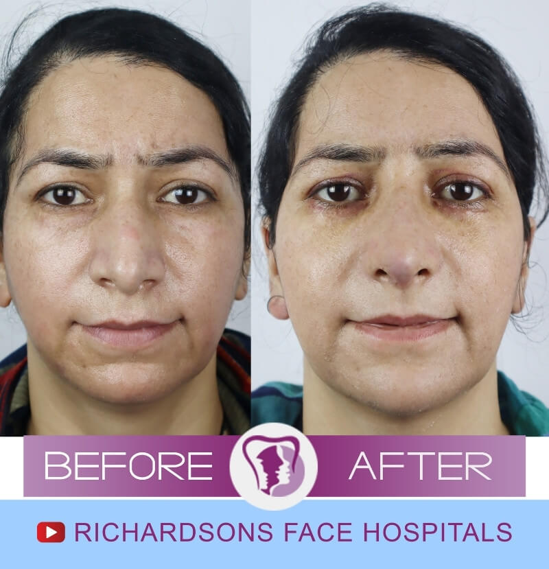 Aafia Face Makeover Surgery