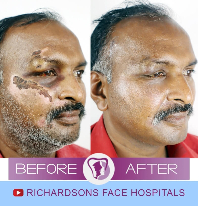 Mohan Facial Trauma Surgery