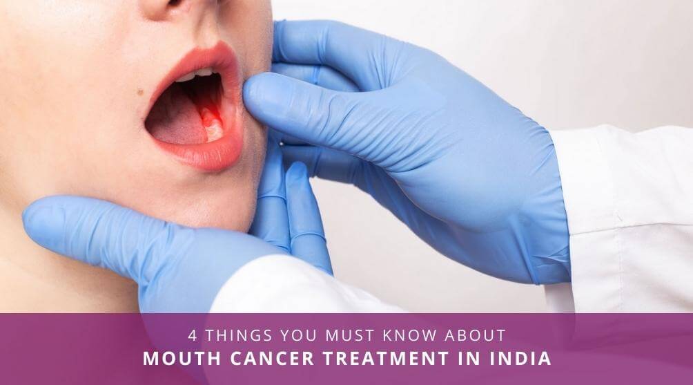 Mouth Cancer Treatment