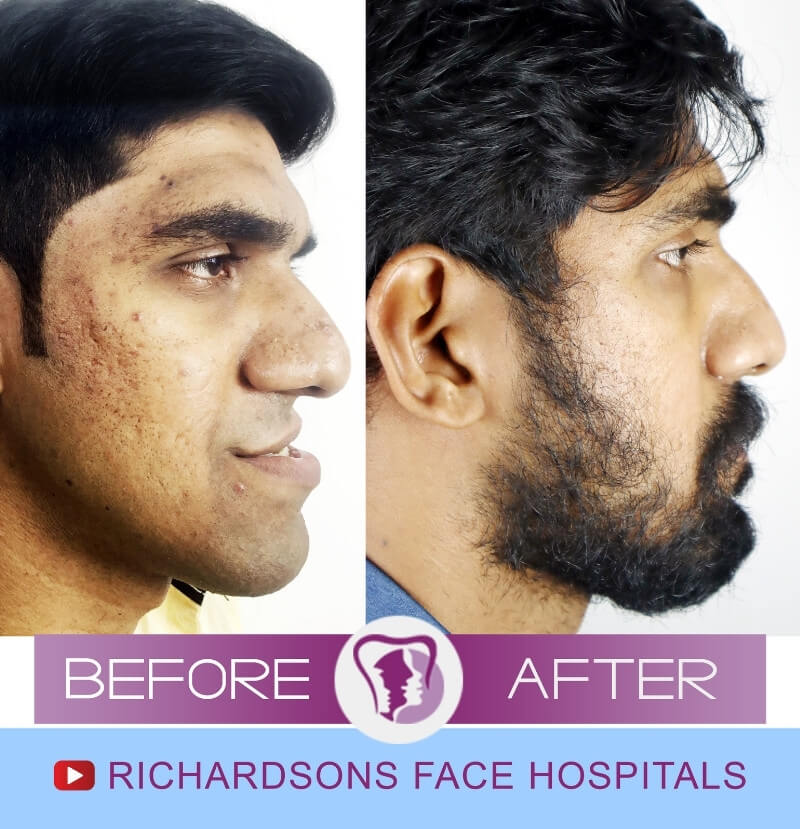 Face Makeover Surgery Hari Krishnan