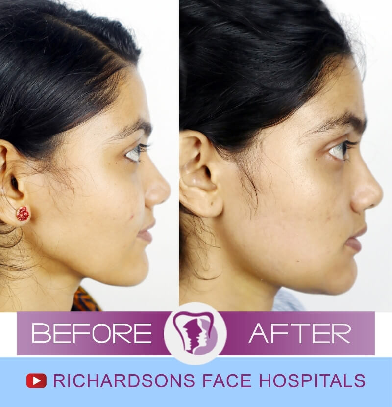Face Makeover Surgery Sree Lakshmi