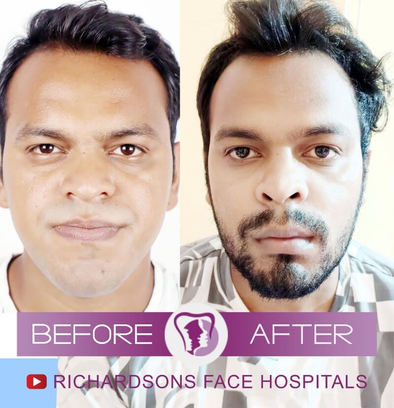 Sourav Paul Bijaw Surgery