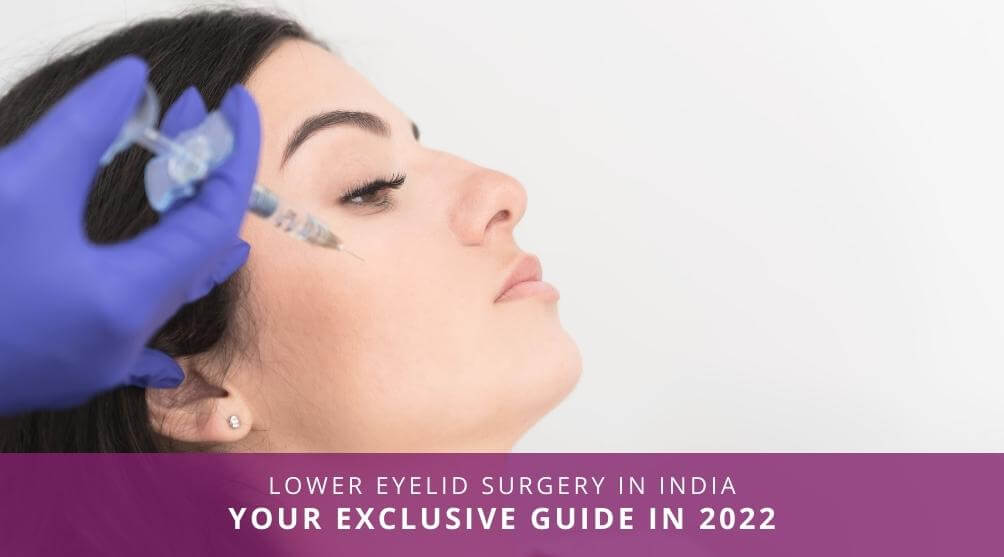 Lower Eyelid Surgery in India