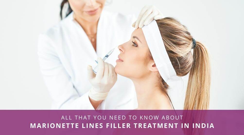 Marionette Lines Filler Treatment In India