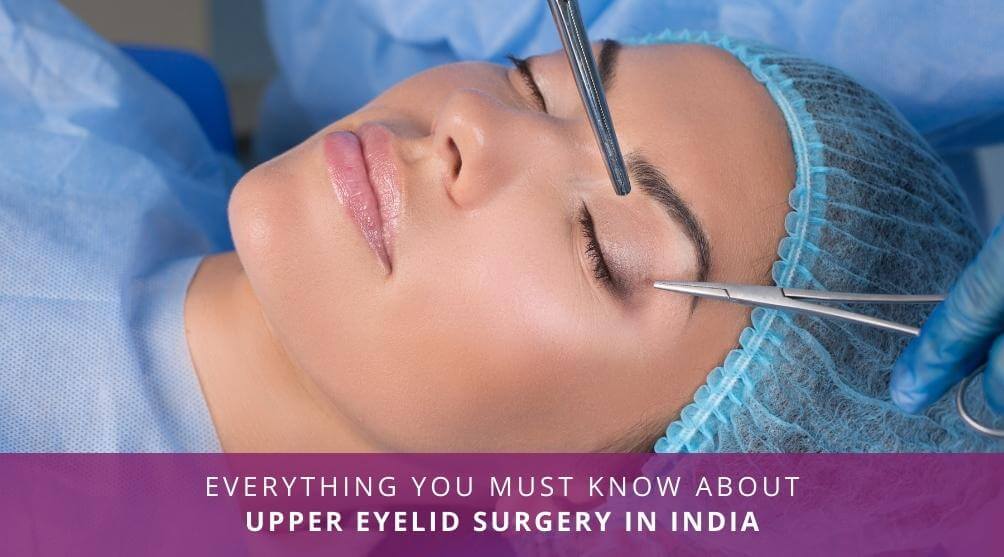 Upper Eyelid Surgery in India