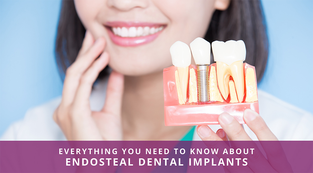 Endosteal Dental Implant