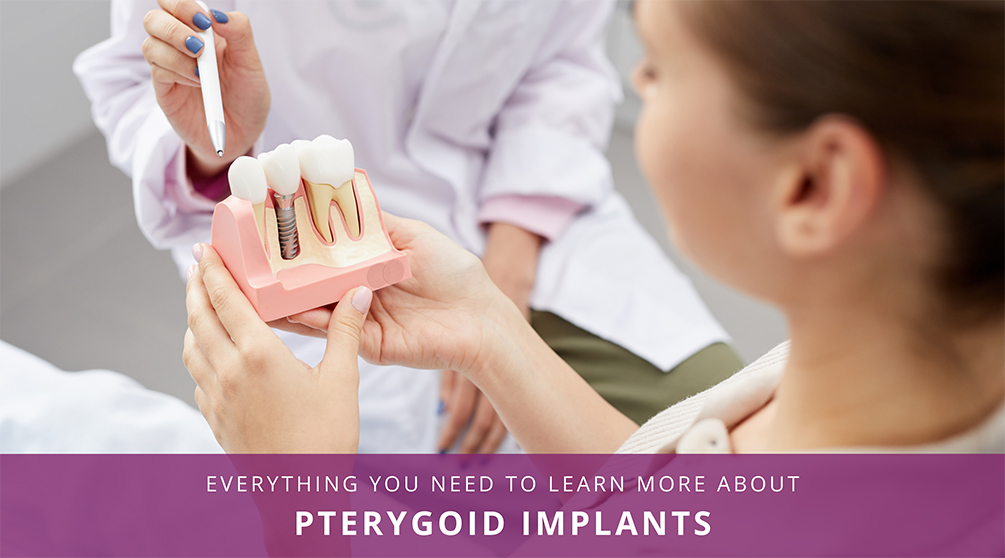 Pterygoid Dental Implant