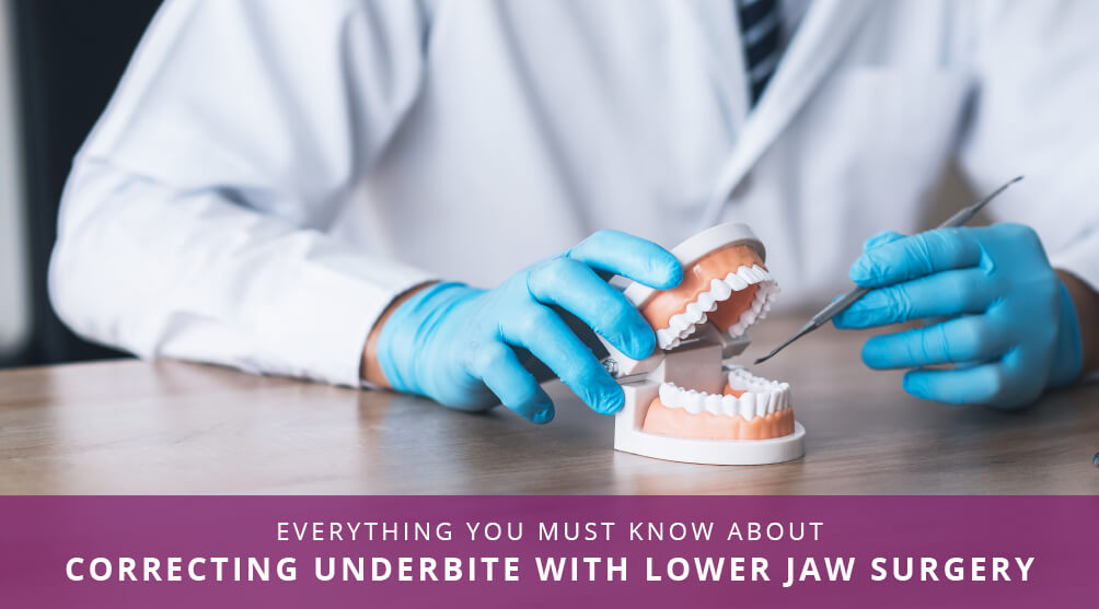 Underbite Lower Jaw Surgery