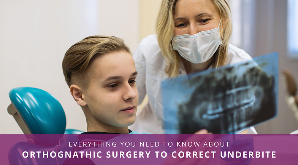 Orthognathic Surgery Underbite