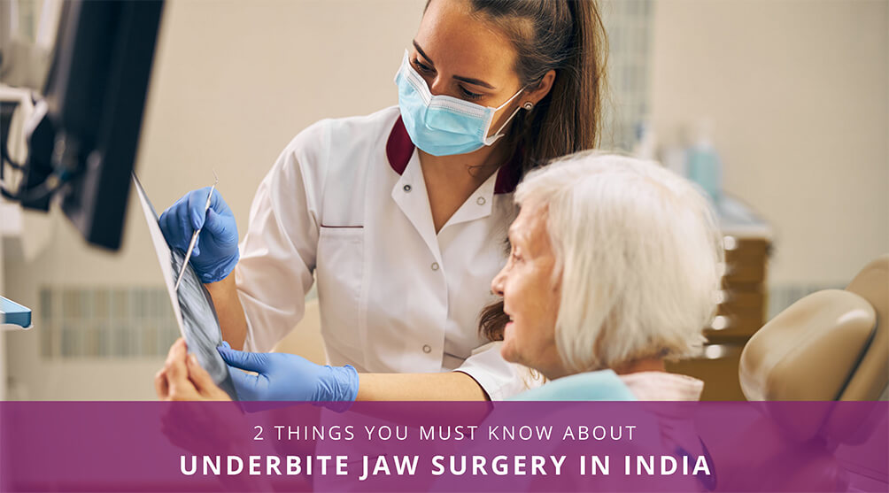 Underbite Jaw Surgery