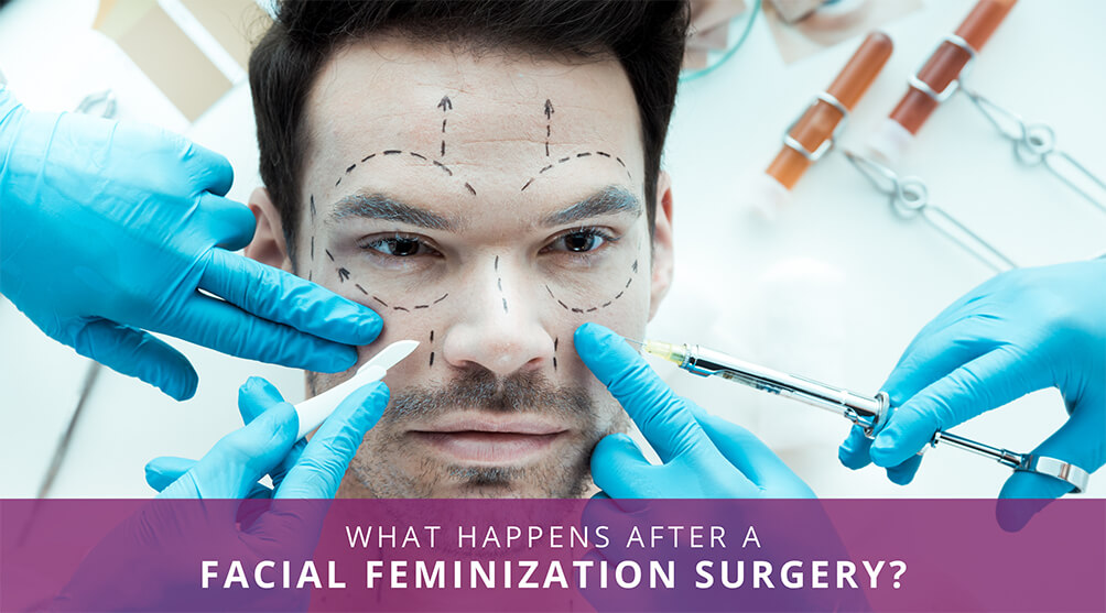 Facial Feminization Surgery India