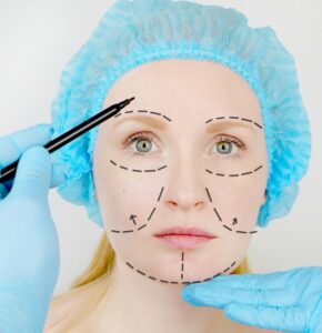 Facial Feminization Surgery Procedure