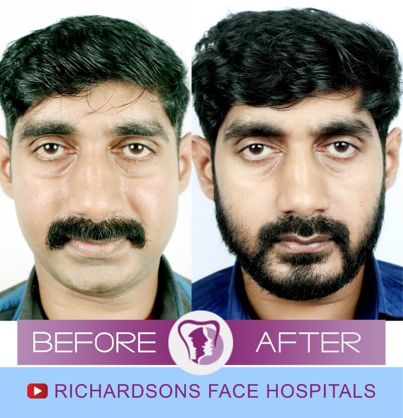 Prajith Orthoganathic Surgery