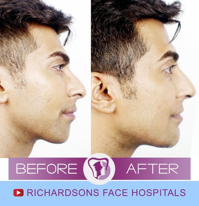 Abdul Face Makeover Side View