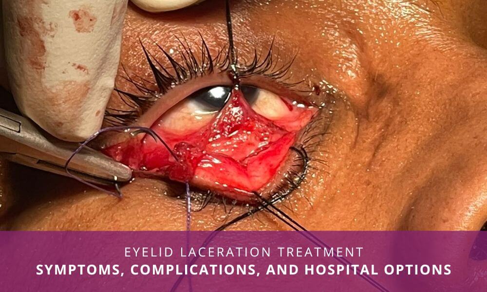 eyelid laceration treatment India