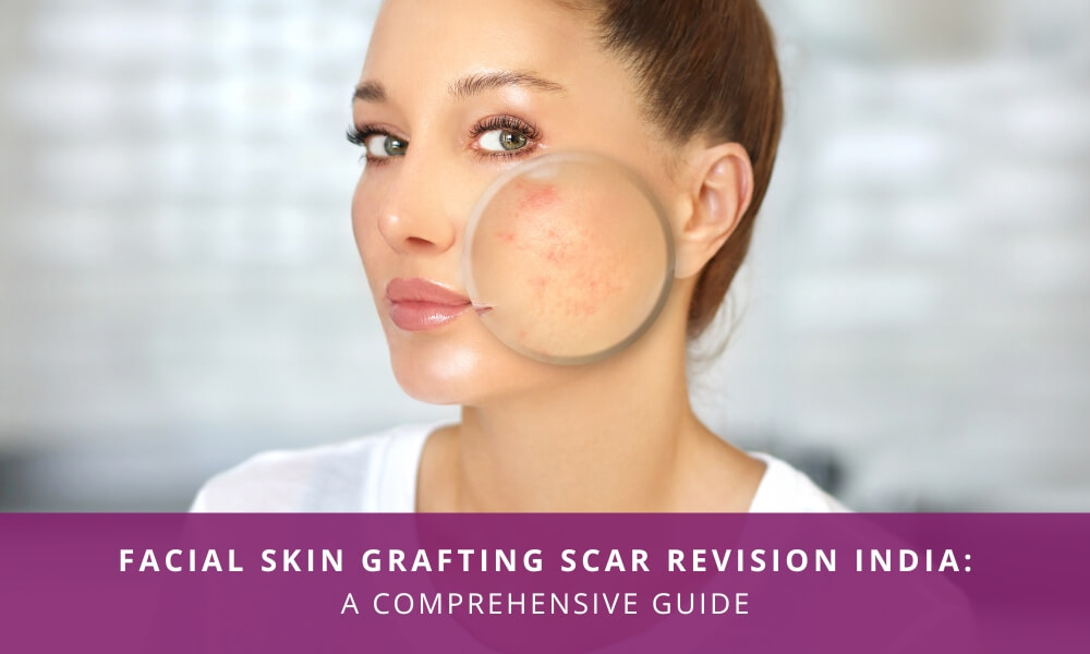 facial skin grafting revision