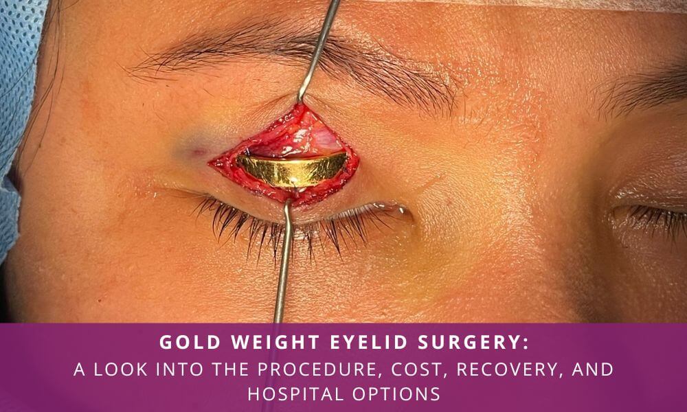 gold weight eyelid surgery