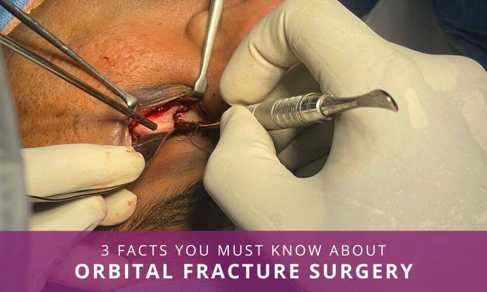orbital fracture surgery india