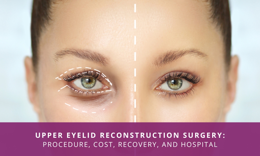 upper eyelid reconstruction surgery