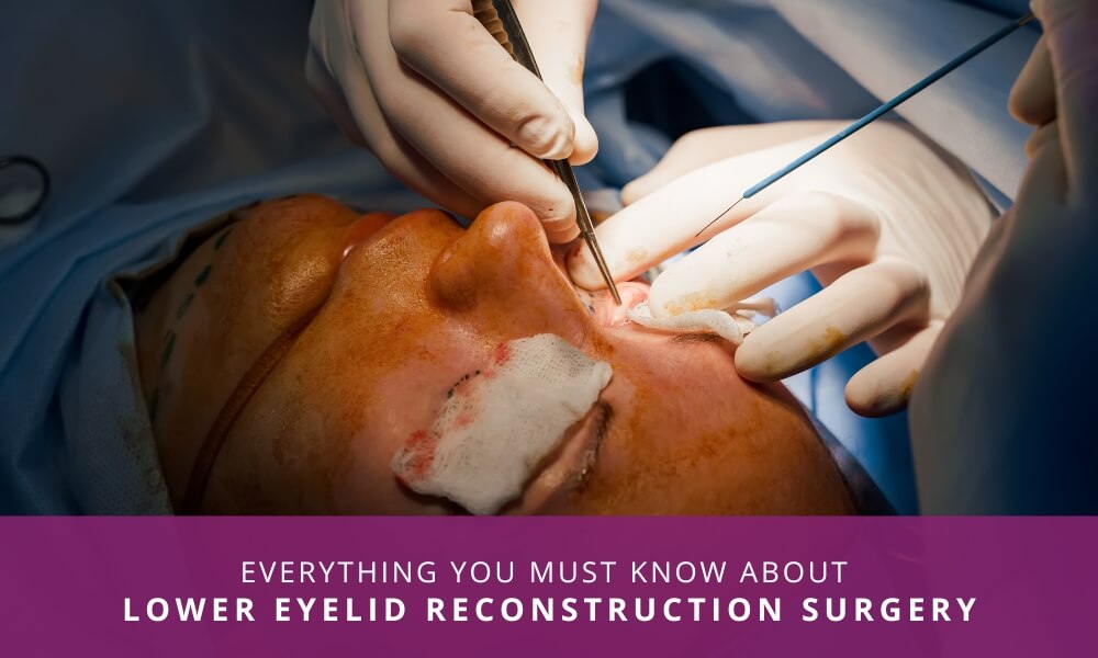 lower eyelid reconstruction surgery