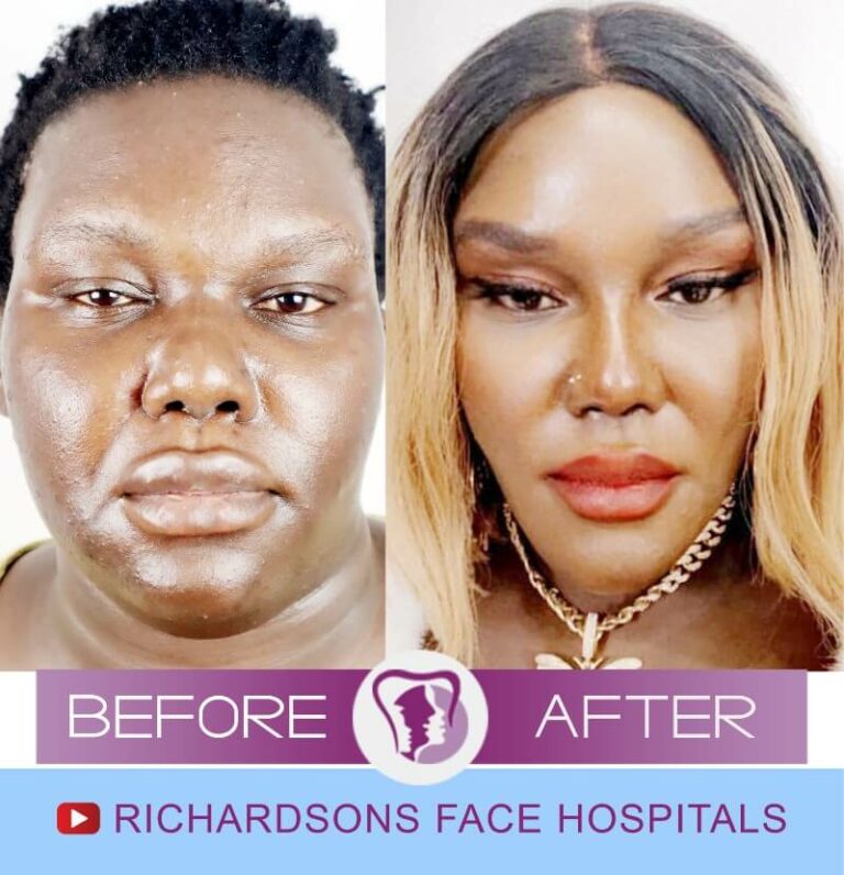 Complete Face Change Plastic Surgery