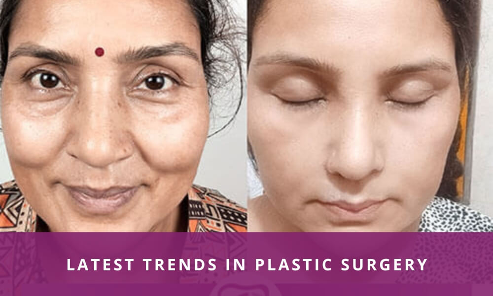 Latest trends in plastic surgery