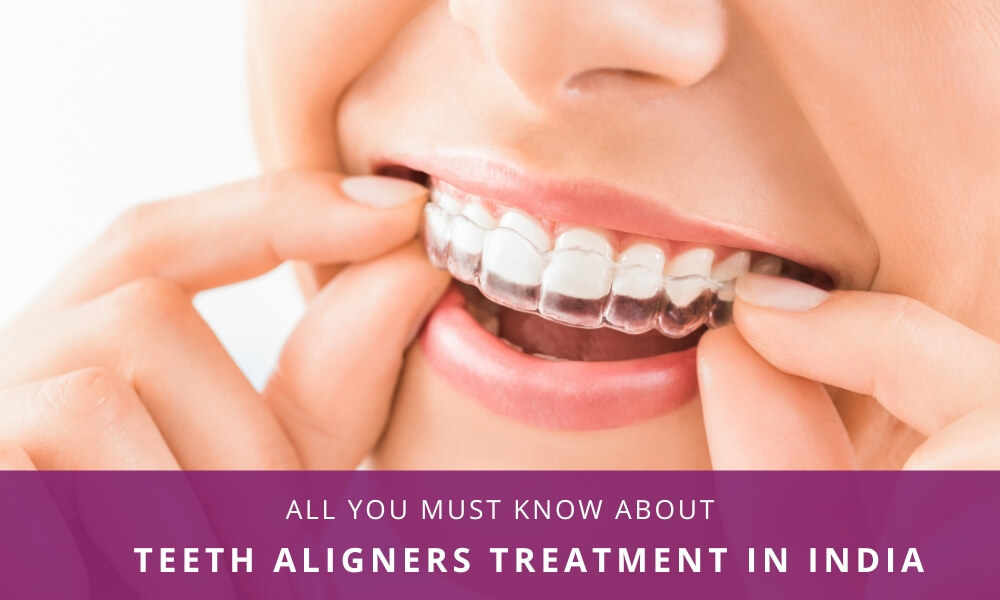 Teeth Aligners Treatment in India