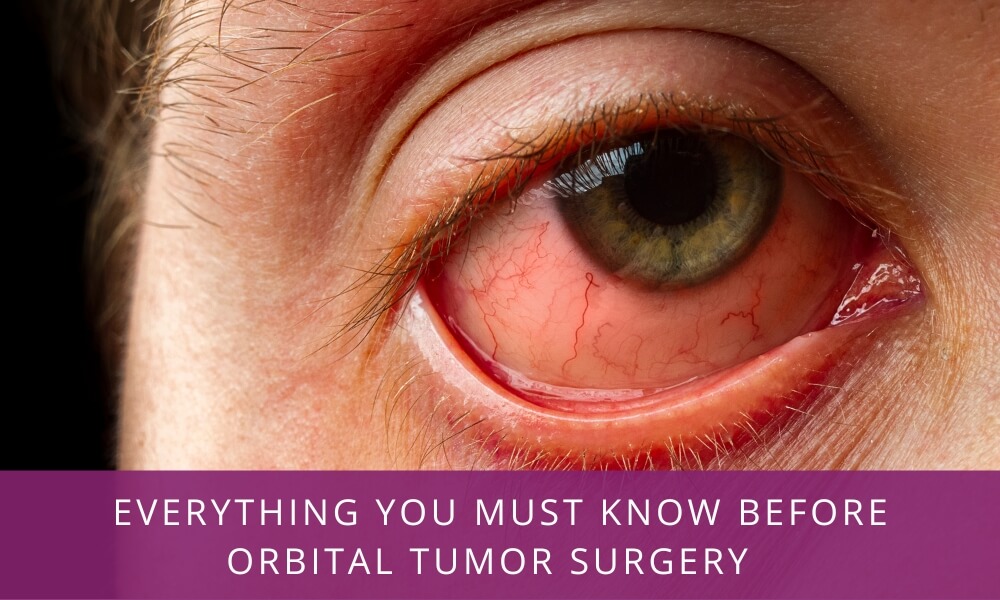 Orbital Tumor Surgery