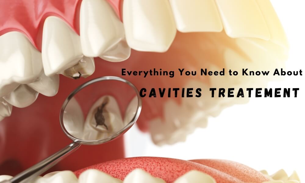 Cavities treatment