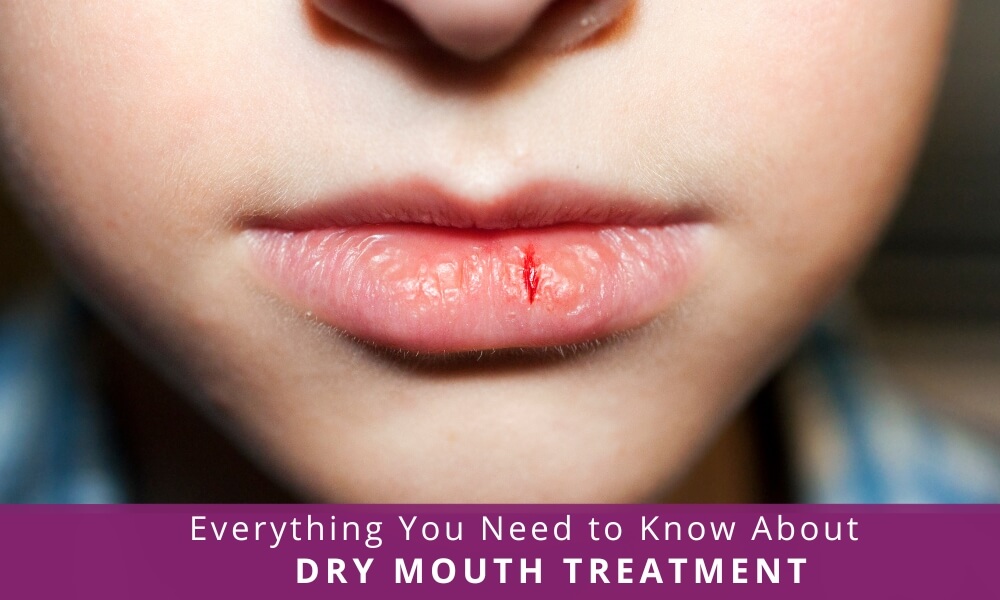 Dry Mouth Treatment