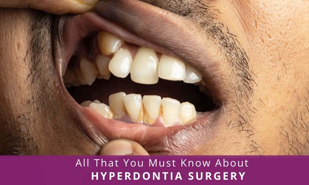 Hyperdontia Surgery