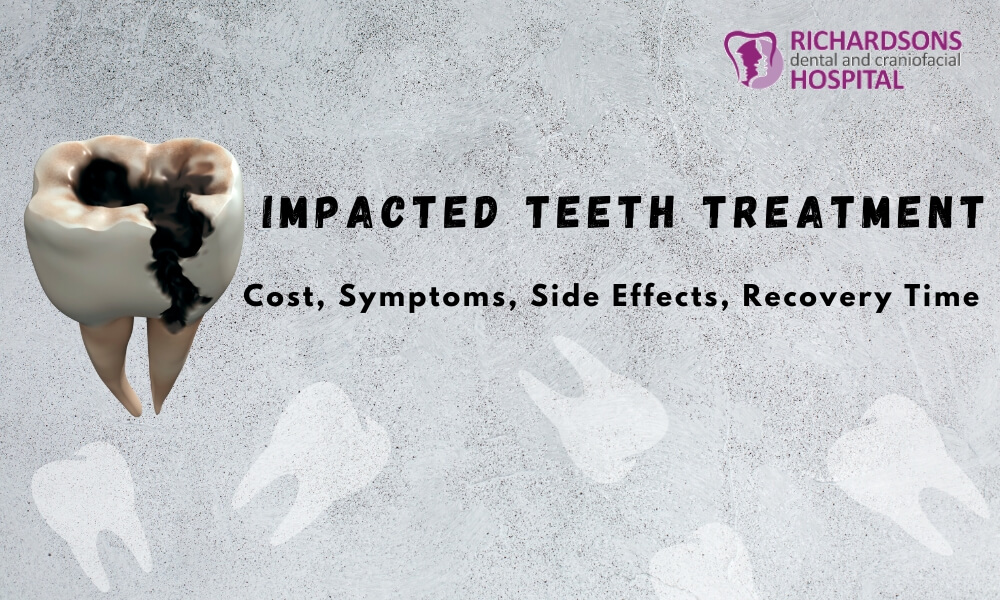 Impacted teeth treatment