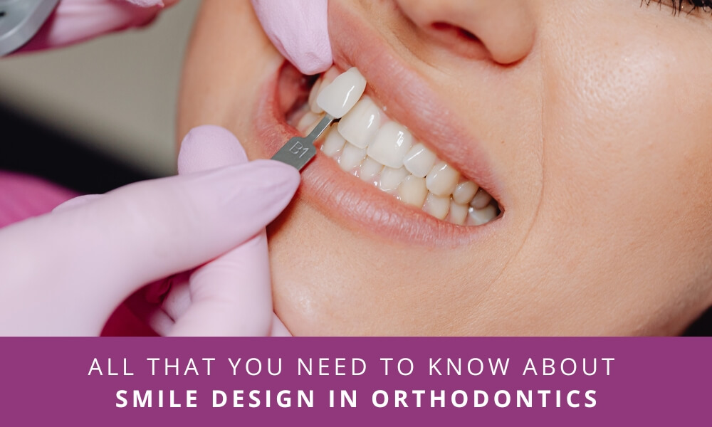 Smile design in orthodontics