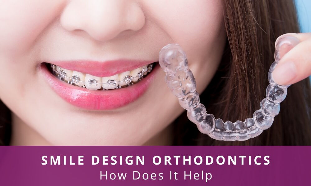 Smile design orthodontics