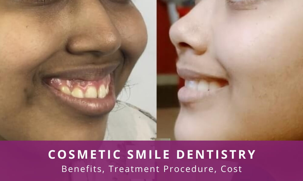 cosmetic smile dentistry