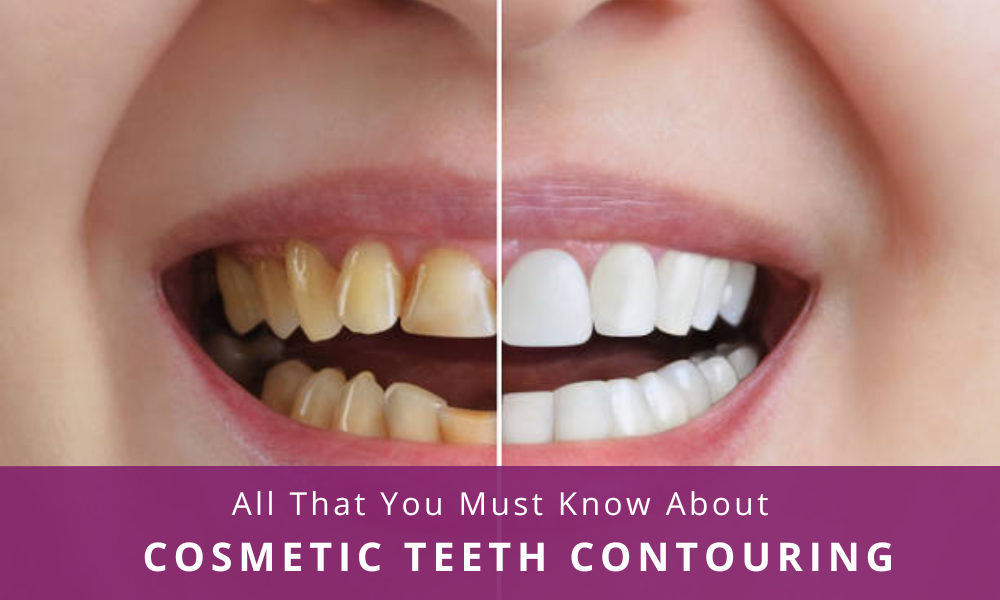cosmetic teeth contouring