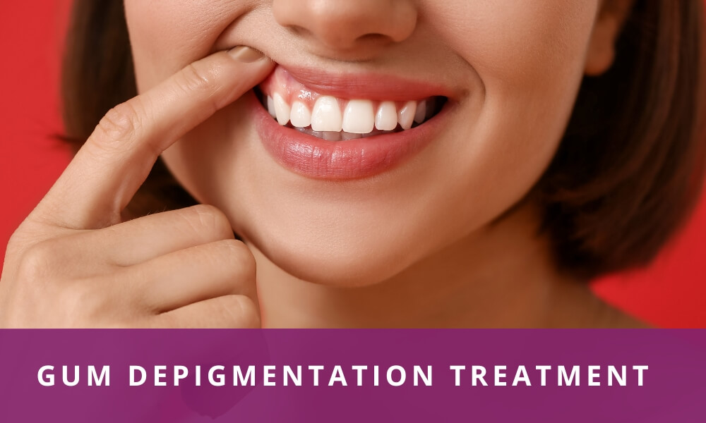 gum depigmentation treatment