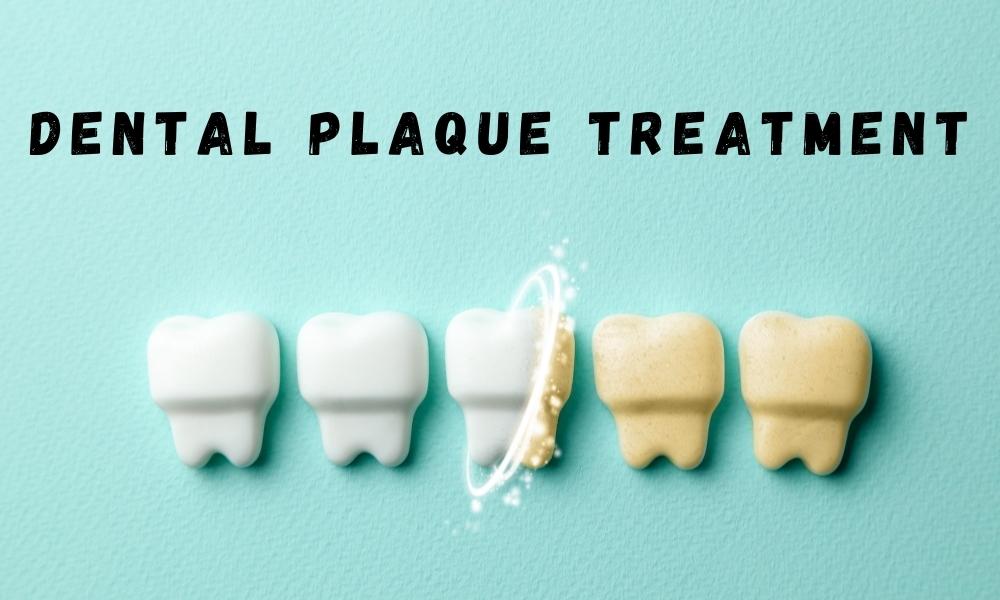 dental plaque treatment